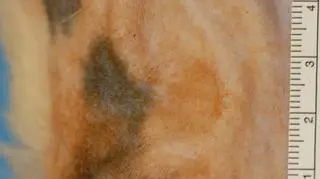 Sztuczne ludzkie ucho wyhodowane na szczurze