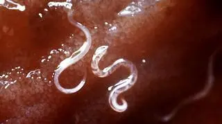 Tęgoryjec dwunastnicy (Ancylostoma duodenale)