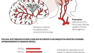 Udar mózgu (infografika PAP)