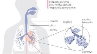 Wpływ tlenków azotu na zdrowie
