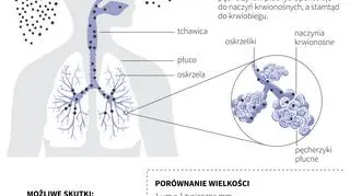Wpływ zanieczyszczeń powietrza na zdrowie (Maria Samczuk, Adam Ziemienowicz/PAP)