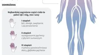 Wychłodzenie organizmu (PAP/Maria Samczuk, Adam Ziemienowicz)