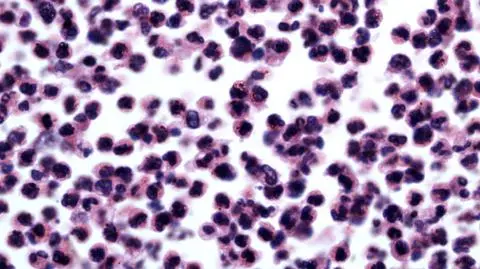 Nowe źródło prądu? Niektóre bakterie żywią się energią elektryczną