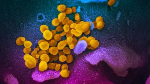 Najważniejsze jest to, w jakiej fazie epidemii się znajdujemy