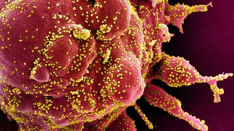 "W perspektywie kilku miesięcy będziemy dysponować cennym narzędziem w walce z COVID-19"