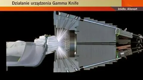 Guza mózgu zniszczą elektronicznym nożem