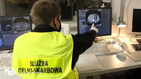 Przemycał w brzuchu półtora kilograma heroiny. Tomografia wykazała prawie sto kapsułek