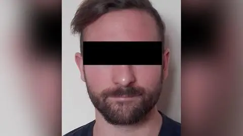 Chciał zmylić policję, zoperował nos. Wpadł w hotelu