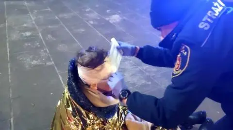 Potknęła się i upadła twarzą na chodnik 