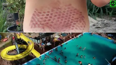 Mama Nikodema twierdzi, że jej syn został przyssany do dysz basenu