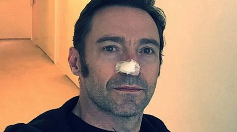 Hugh Jackman walczy z rakiem