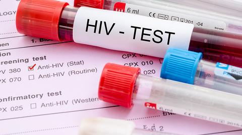 Świadome zakażenie wirusem HIV nie jest już przestępstwem