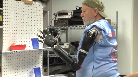 Świat technologii: pierwszy na świecie człowiek z robotycznymi kończynami