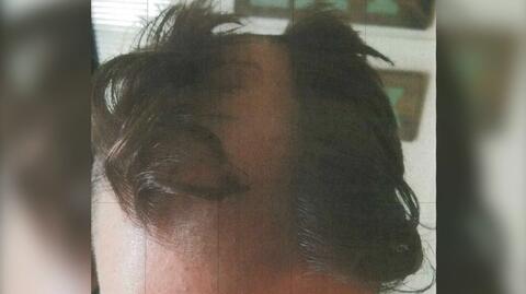 Fryzjer stanie przed sądem za złe cięcie włosów 