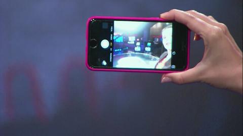 Czym jest "łokieć selfie" i "smartfonowy kciuk"?
