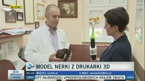 Polscy lekarze korzystają z wydrukowanej w 3D nerki 