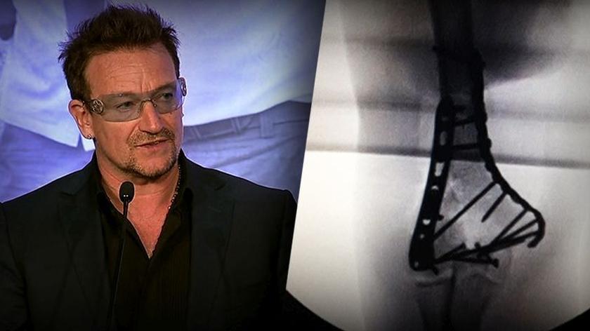 03.01.2015 | Szokujące wyznanie lidera U2. Już nigdy nie zagra na gitarze?