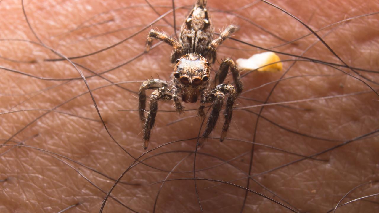 Estados Unidos de América.  Mordida por arañas, sufre de fascitis necrosante causada por bacterias ‘come-cuerpos’