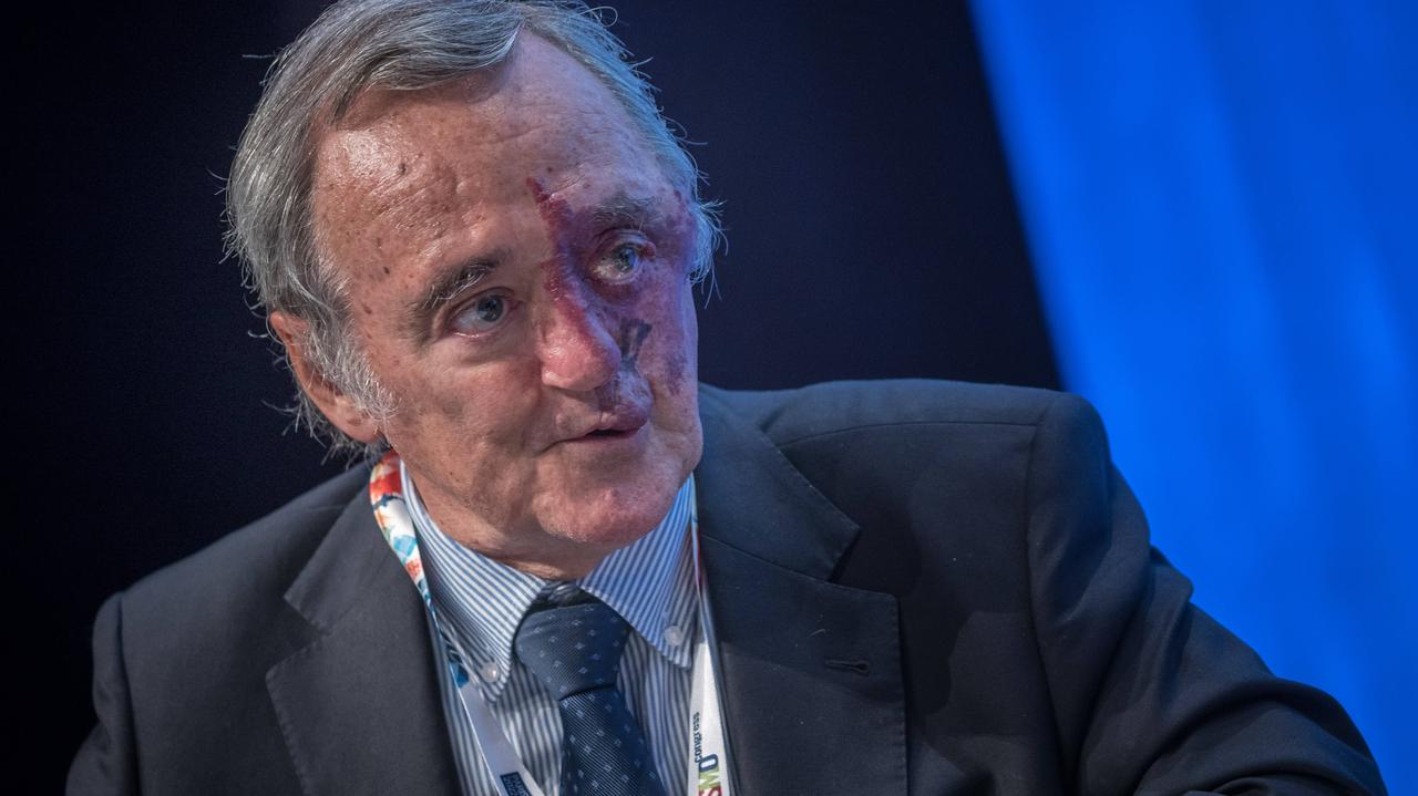 "Guzy zniknęły całkowicie". Naukowiec dokonał przełomu w badaniach nad najgroźniejszym rakiem