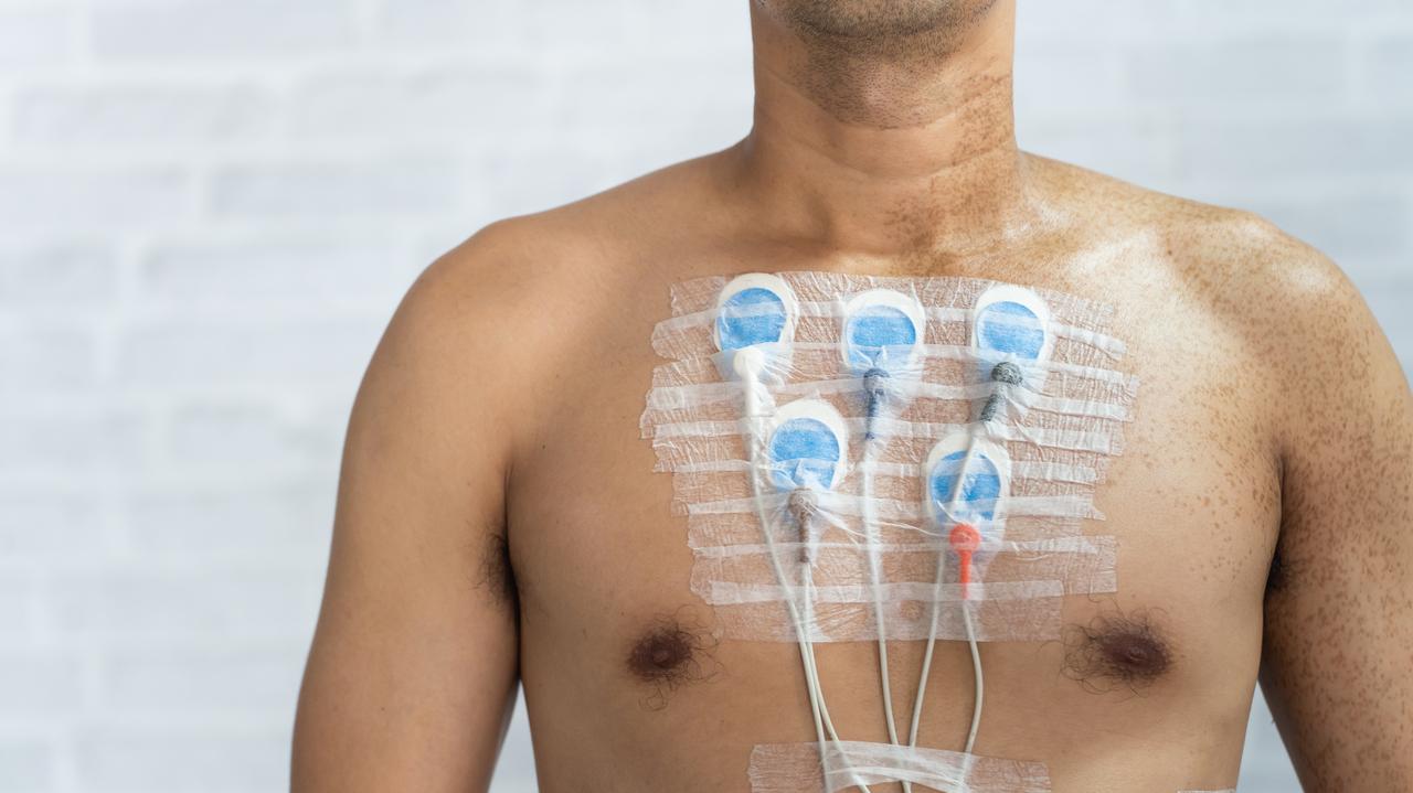 Dotyka 60 milionów ludzi. Przełom w badaniach nad najczęstszą arytmią serca