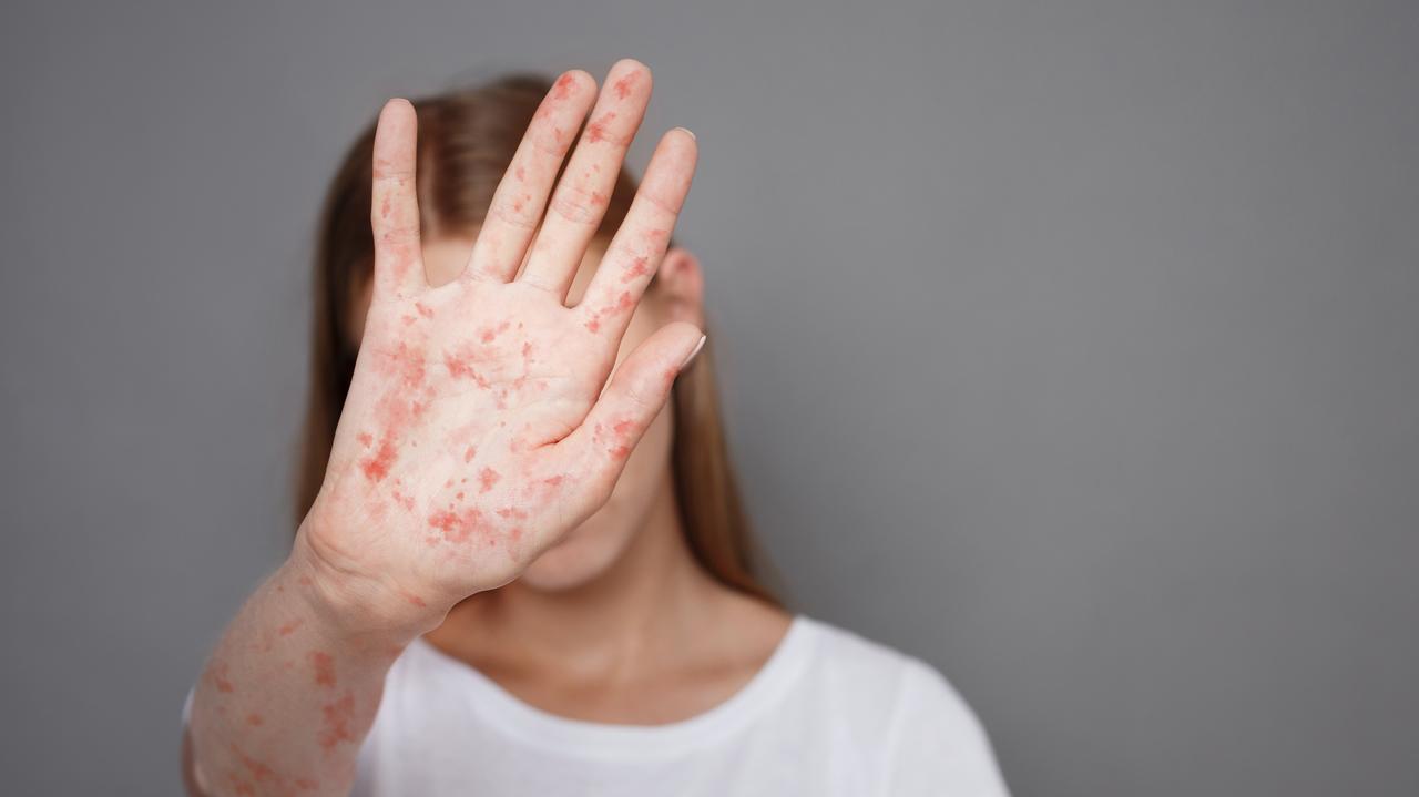 Odra w Polsce. Nowe przypadki na Podkarpaciu