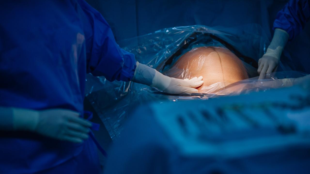 Nie każdy szpital jest miejscem na cesarkę. Co decyduje o bezpieczeństwie?