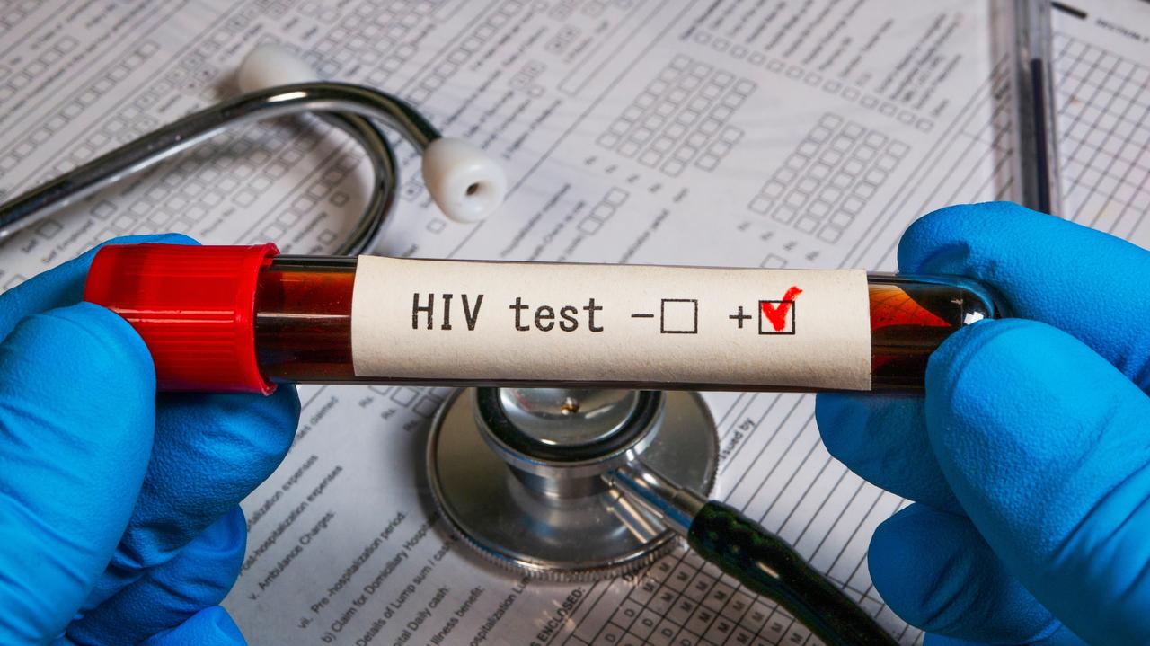 Ważne odkrycie dotyczące HIV. Dożywotnia terapia nie będzie już potrzebna?
