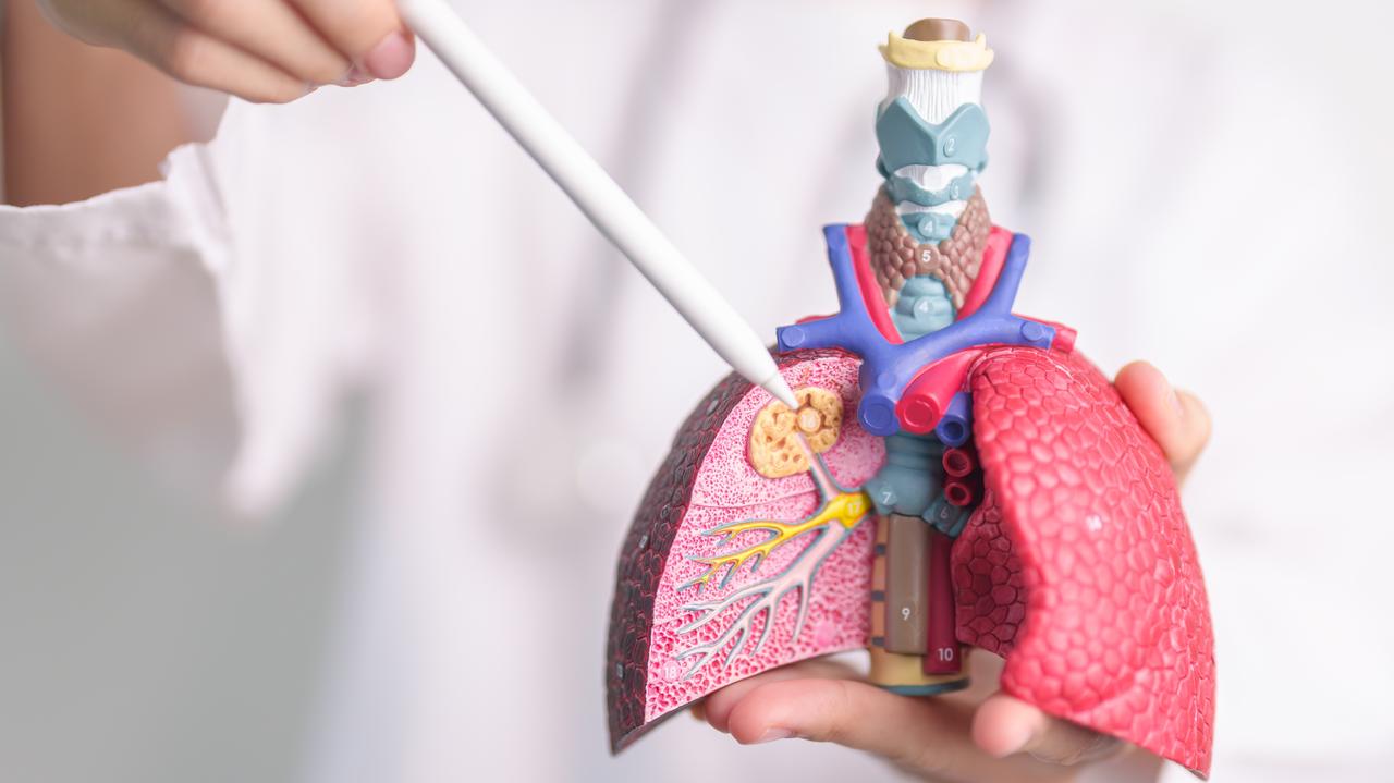 Leczenie raka płuca. Polska dorównuje Europie, ale są wyzwania