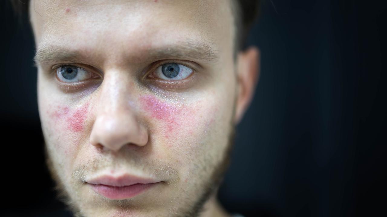 Powszechny wirus groźniejszy niż przypuszczano? Przełomowe odkrycie