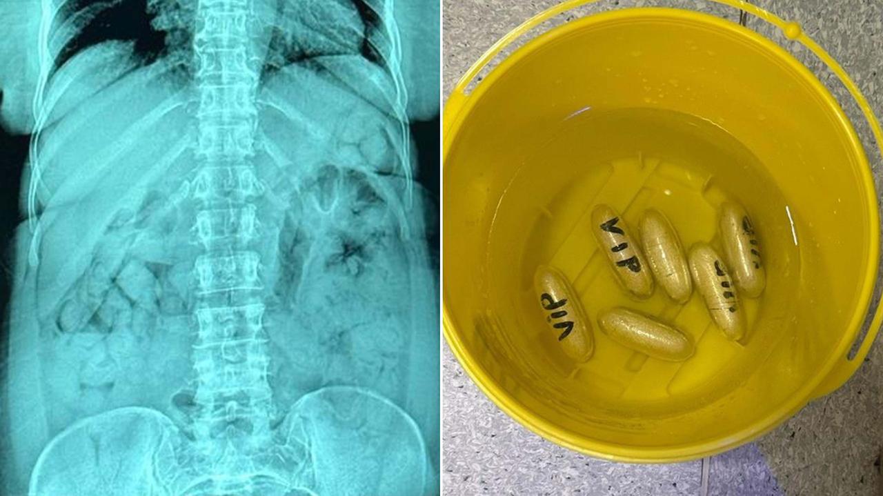 46-latka zatrzymana na lotnisku w Bergamo. W żołądku 120 kapsułek z heroiną