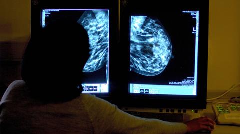 Kampania "Biustowniczki" zachęca do badania piersi