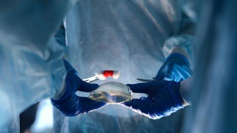 implant shutterstock_2425386005