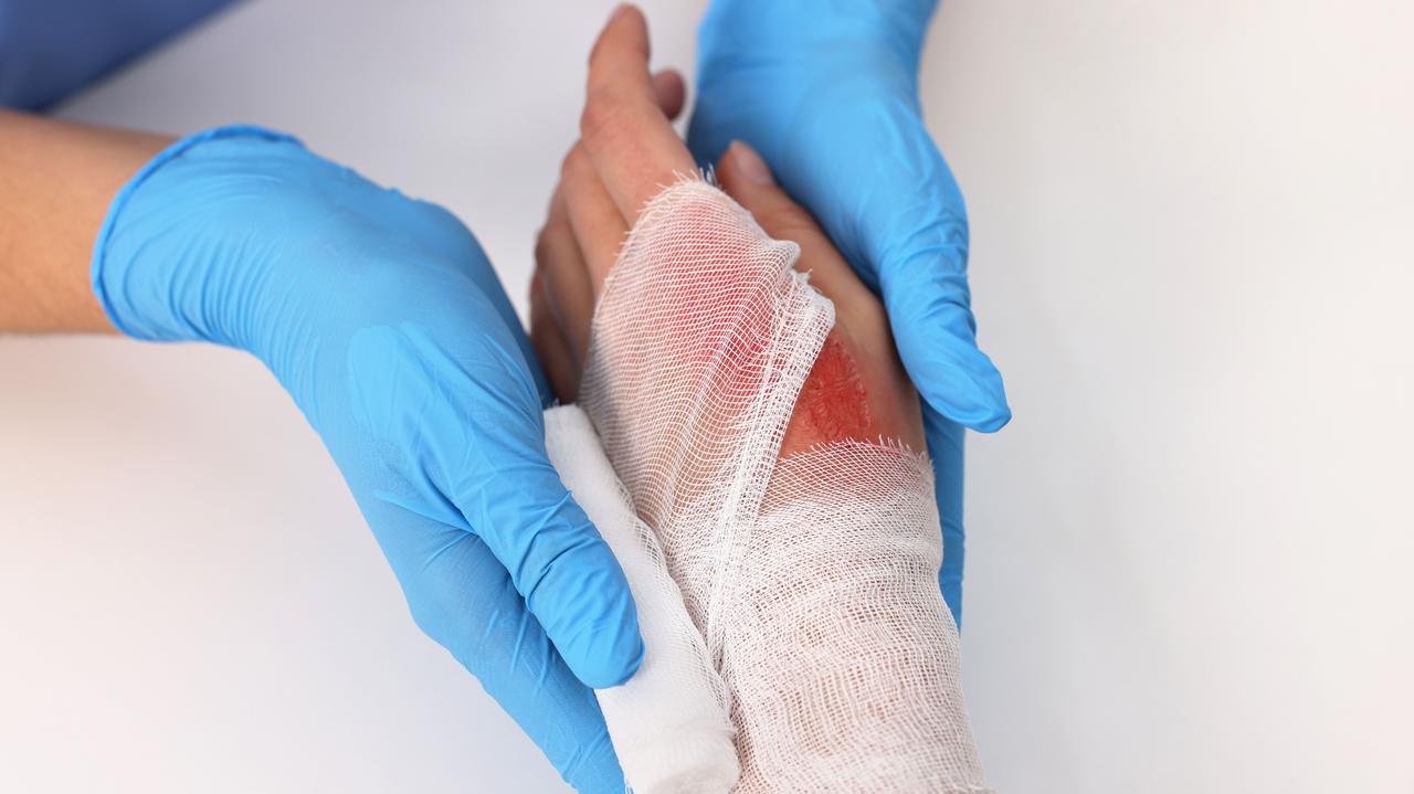 Oparzenia to więcej niż uraz skóry. "Wpływ na cały organizm"