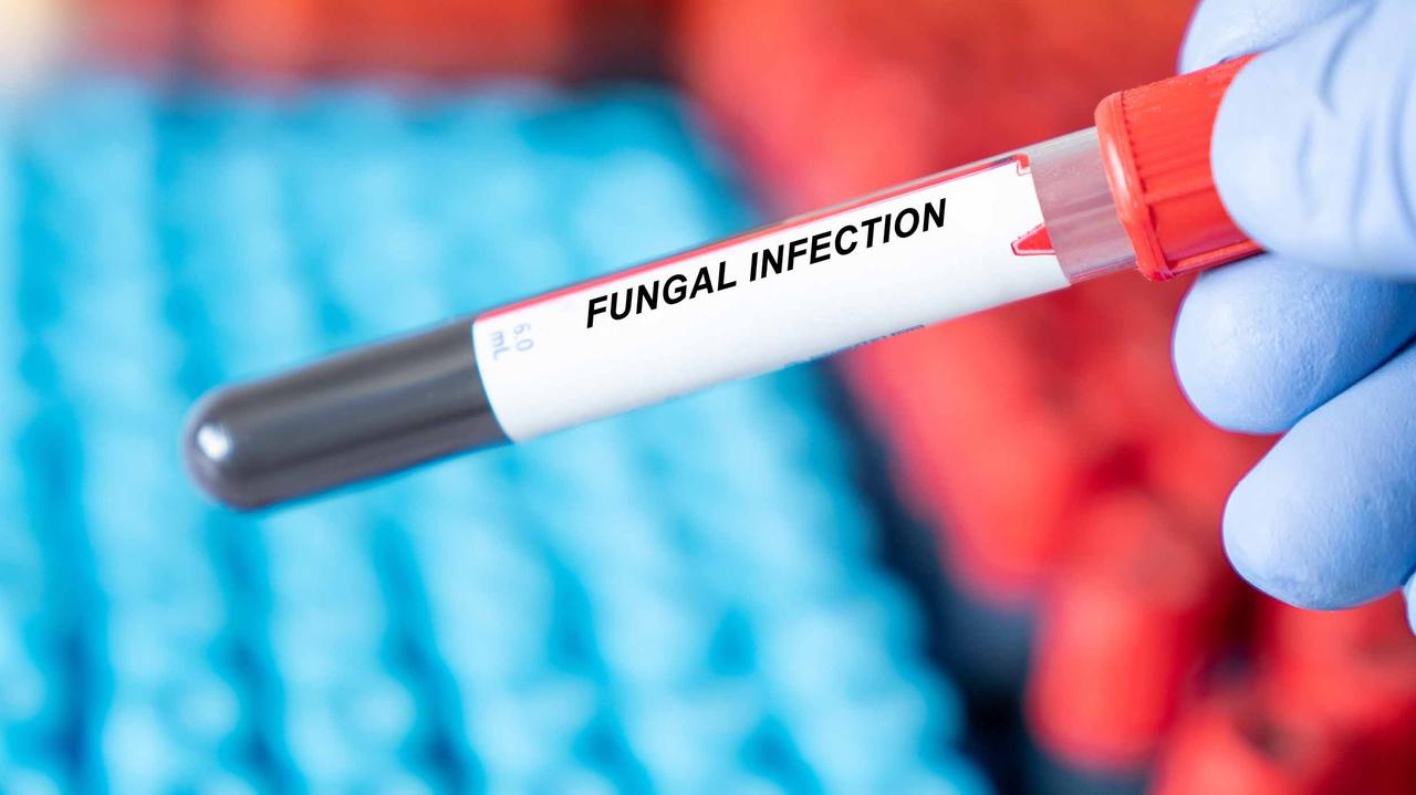 Atakują, gdy odporność zawodzi. Mikrobiolog apeluje o czujność