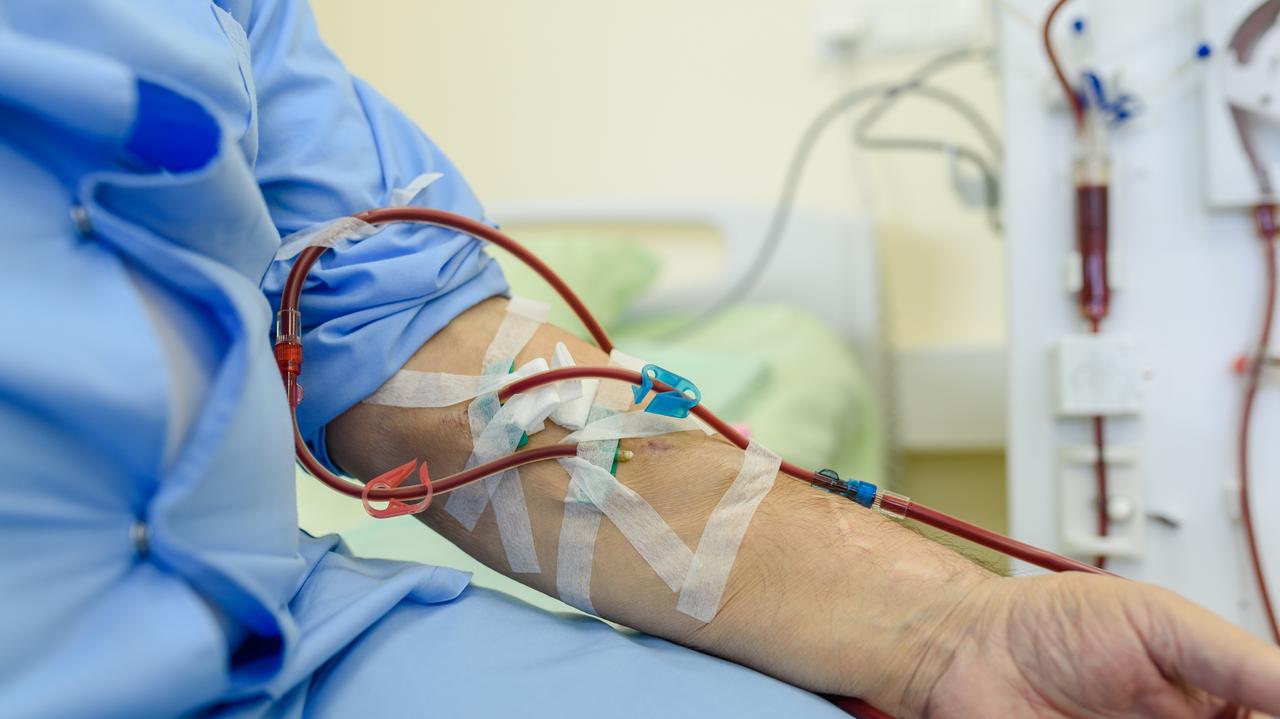 Mechanicznie wyprali krew ze "złego" cholesterolu. Spadek stężenia o 80 procent