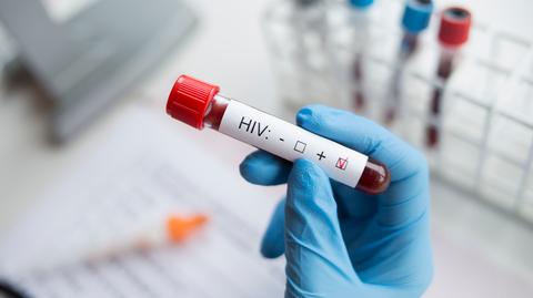 Lekarz Jakub Wyszyński: życie osoby z HIV nie różni się od życia innej osoby oprócz tego, że trzeba regularnie przyjmować leki