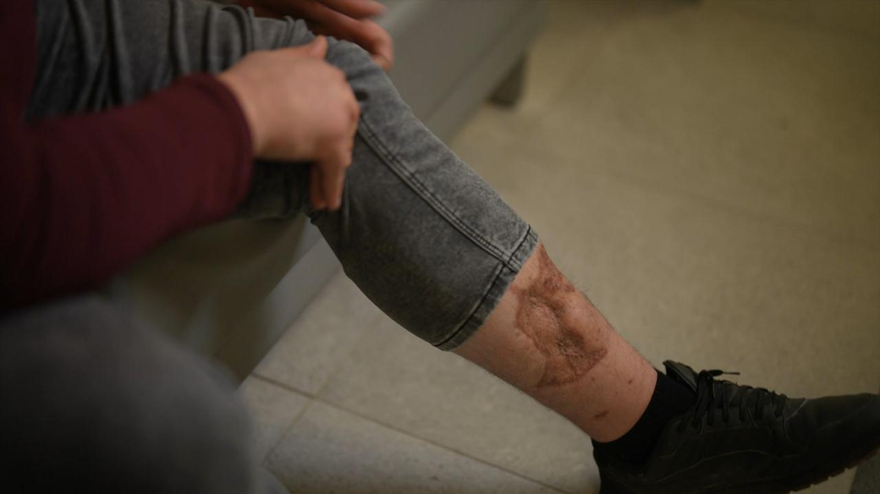 "O tym zapominamy", a "większości przypadków można uniknąć"