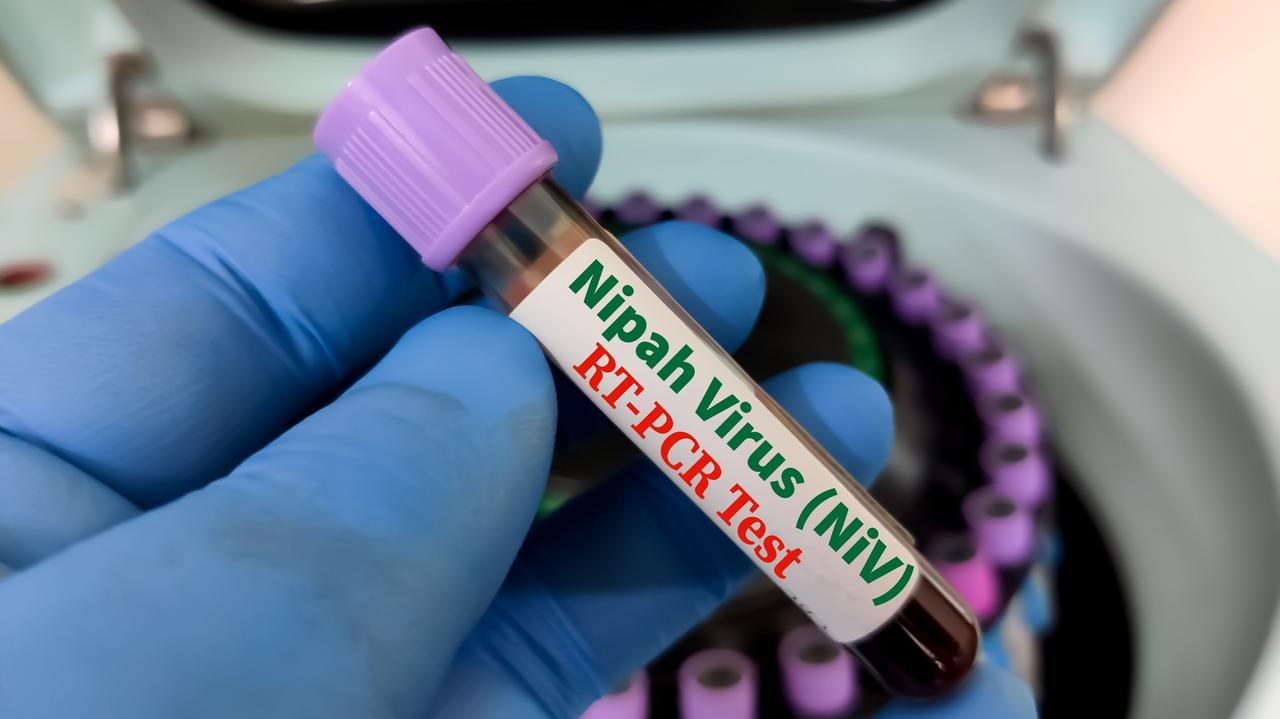 Zjadliwy Nipah. "Szybko mutuje i ma potencjał wywołania epidemii"