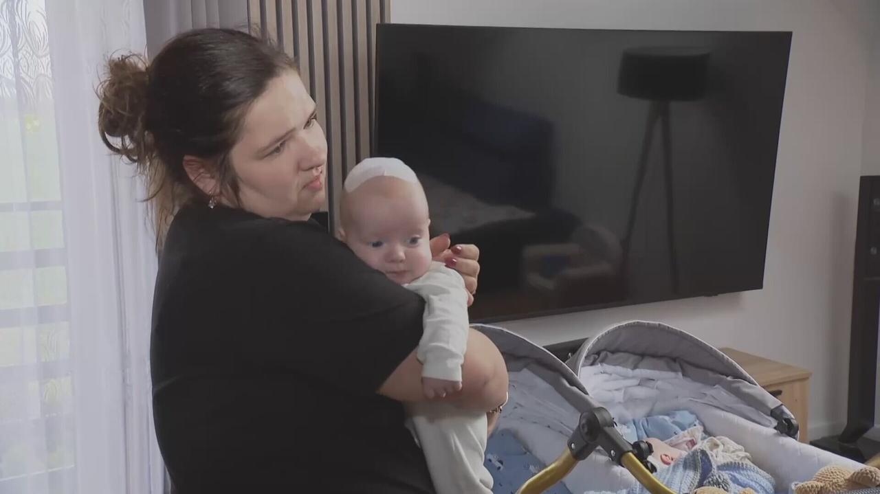 Trzymiesięczne bliźnięta zoperowane równocześnie