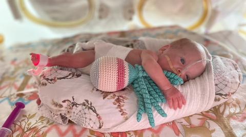 W Szpitalu Miejskim w Rudzie Śląskiej uratowali życie maleńkiej Marty, która przyszła na świat w 26 tygodniu ciąży