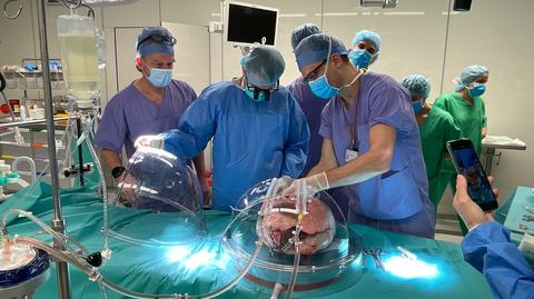 Lekarze z Gdańska zregenerowali płuco pobrane od dawcy 