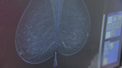 Mammografia - badanie, które może uratować życie