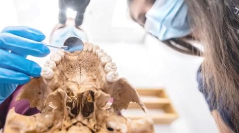 Dentyści badają zęby 500-letnich czaszek