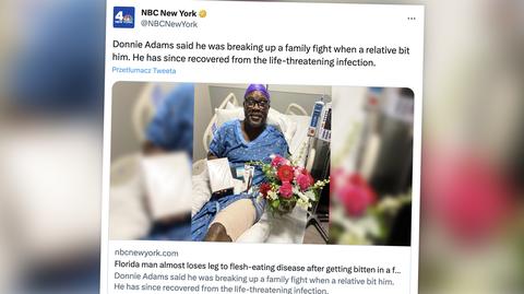 Donnie Adams trafił do szpitala HCA Florida Northside w Saint Petersburgu, po zakażeniu "mięsożerną" bakterią