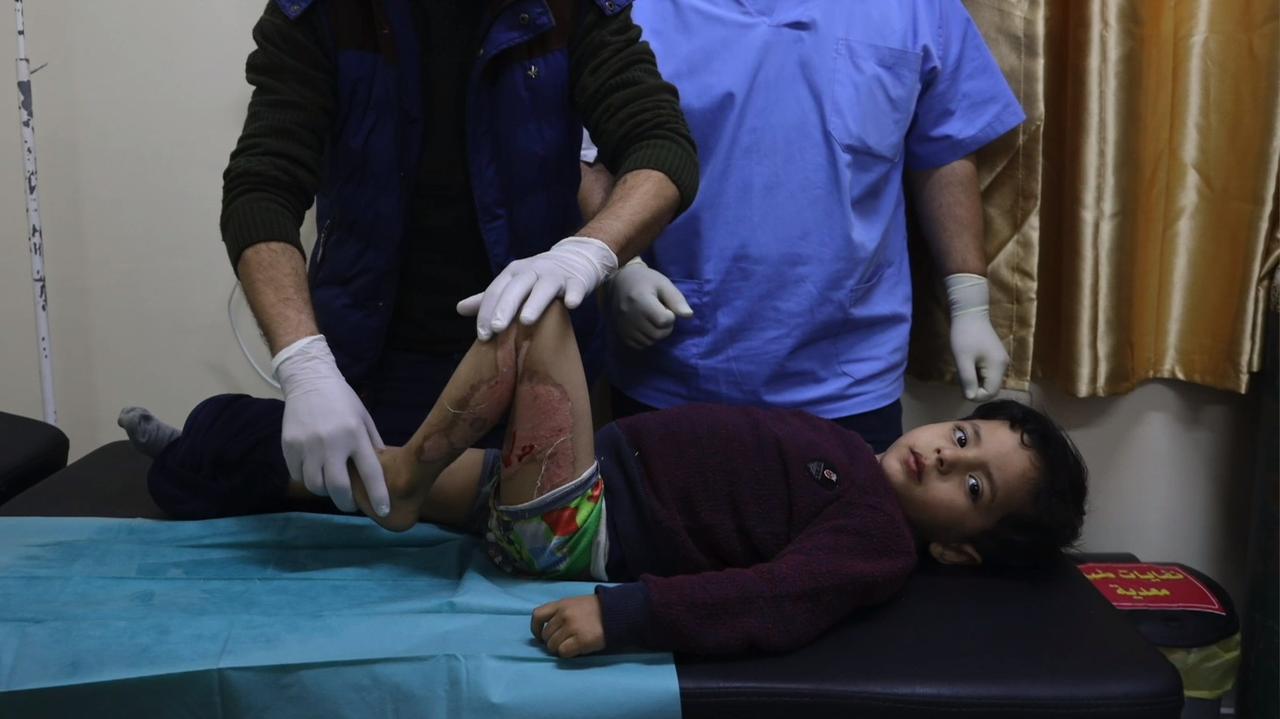 Kolumbia chce leczyć dzieci ranne podczas izraelskich bombardowań. Decyzja prezydenta