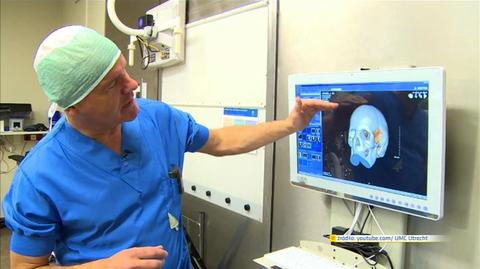 Przeszczepiono czaszkę wydrukowaną w technice 3D
