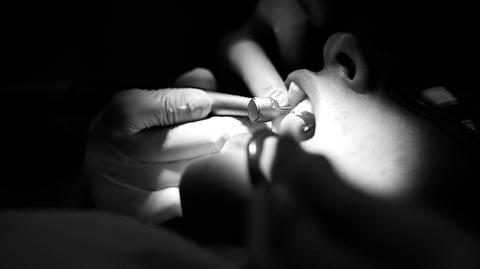 Wizyta jak z horroru: pacjent połknął pilnik dentystyczny