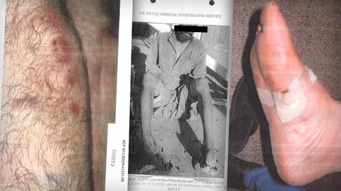 Pentagon opublikował niemal 200 nowych zdjęć torturowanych więźniów