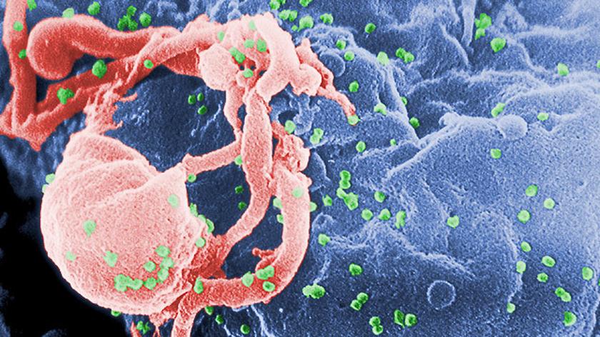 18-latka zarażona HIV całkowicie zdrowa