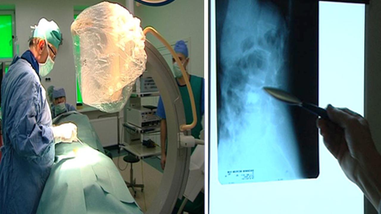 Cicha epidemia osteoporozy. Tylko jeden na 10 chorych jest leczony